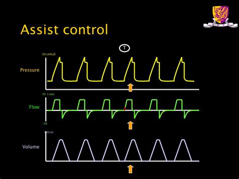 PPT - Mechanical ventilation PowerPoint Presentation, free download ...