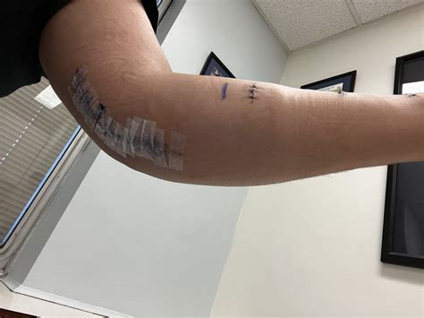 Tommy john tattoo - Bronctattooaus.com