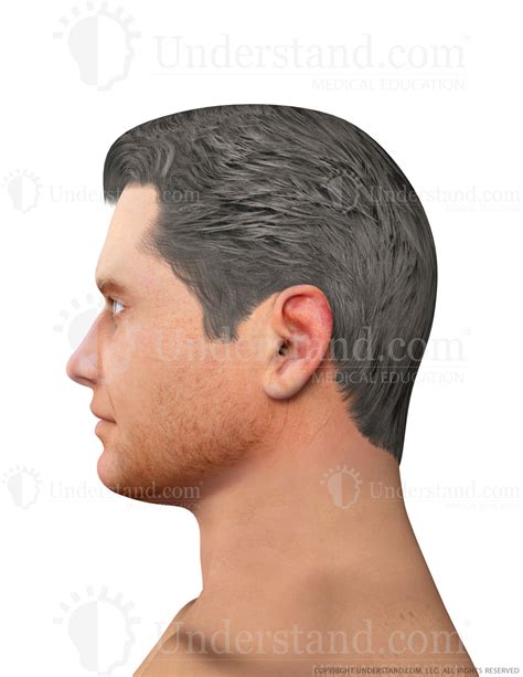 face male left lateral image understandcom