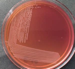 macconkey  composition  colony characteristics