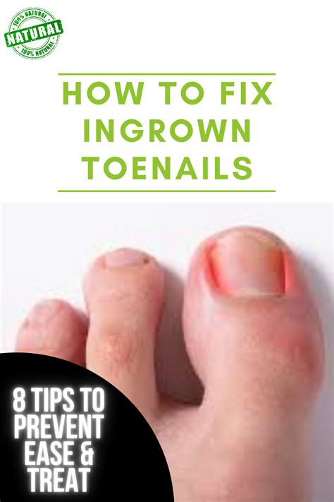 how to fix ingrown toenails