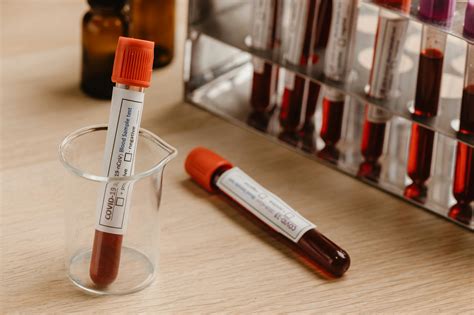 Close-Up Photo of a Blood Samples in a Blood Collection TubesFree