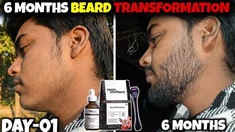 man matters beard kit  months result man matters beard growth kit