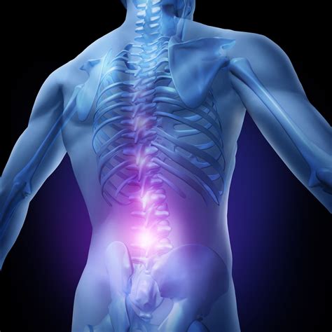 Herniated Disc Treatment Gets to the Base of Your Pain - Riverside Pain