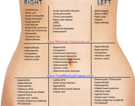 undifferentiated patient abdo pain flashcards quizlet