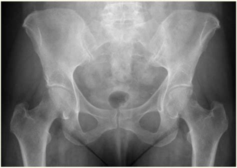 diagram  hip radiology quizlet