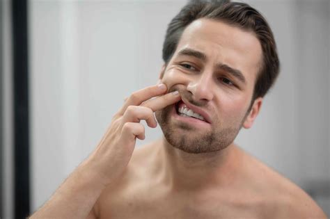 Gum Recession - Causes, Symptoms, Treatment, and Prevention