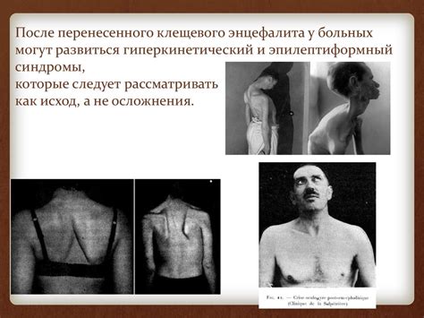 Клещевой энцефалит - презентация онлайн
