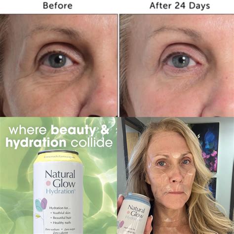 Souirensu It Works: My Before & After Will Blow You Away! Image 13