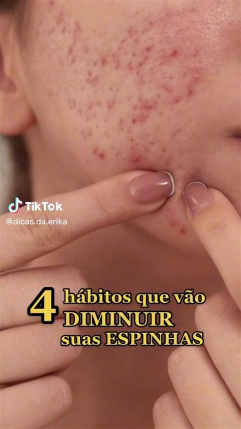 Como Tirar A Espinha Do Rosto