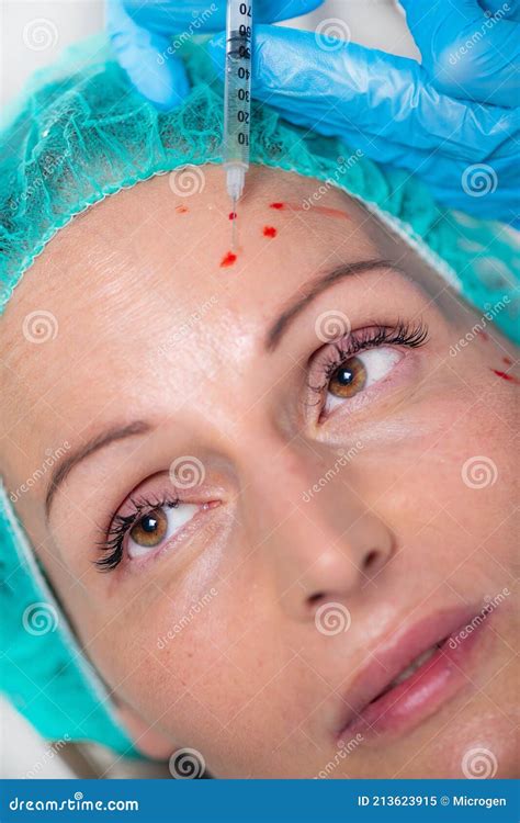 PRP Face Injecting Treatment. Anti-Aging Face Treatment Stock Image ...