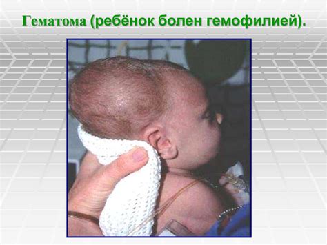 Хирургические заболевания головы - презентация онлайн