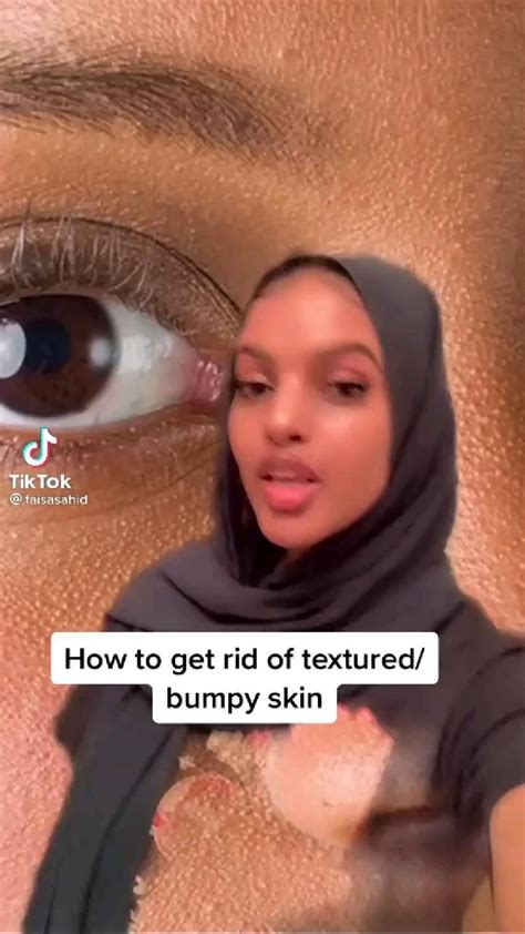 how to get rid of bumpy skin on face