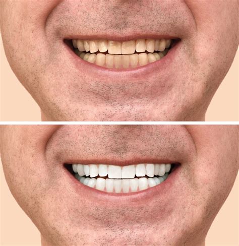 Dental Cosmetic Surgery Clinic at Reynaldo Leahy blog