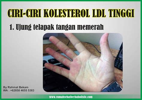catatan volunteer ciri ciri kolesterol ldl tinggi