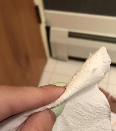 Blood specks when wiping???! | BabyCenter