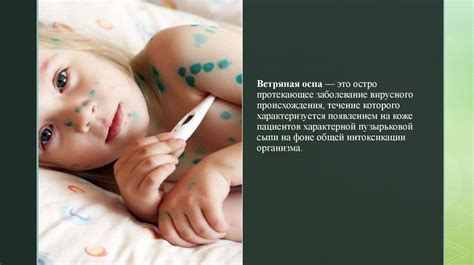 Особо опасные инфекции. Ветряная оспа - презентация онлайн