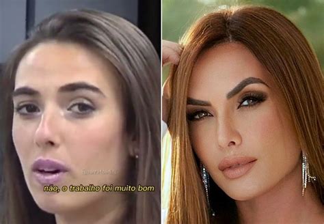 Nicole Bahls Antes E Depois Cirurgia - Nicole Bahls explica mudança de voz em vídeo viral; vídeo