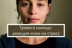 Почему кожа реагирует на стресс высыпанием, пятнами и зудом | Психология