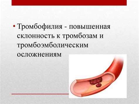 Приобретенная тромбофилия - online presentation