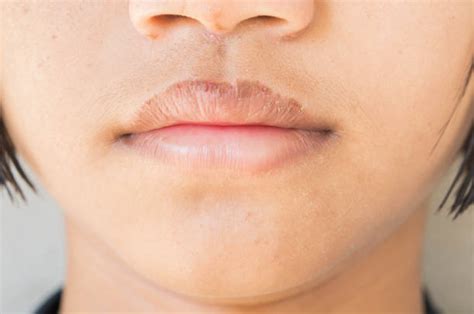 750+ Cracked Lips Stock Photos, Pictures & Royalty-Free Images - iStock