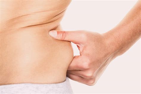 How to Get Rid of Love Handles: Most Effective Treatments to Book In
