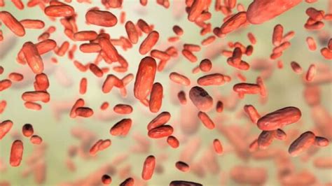 Bordetella holmesii qPCR assay - PCR Assays