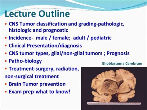 Cns tumors