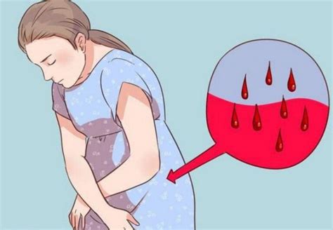 Vomitar Sangue Na Gravidez Prejudica O Bebê