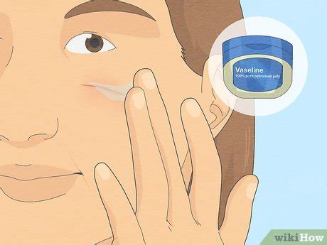 3 Simple Ways to Heal Scratch Marks on Your Face - wikiHow