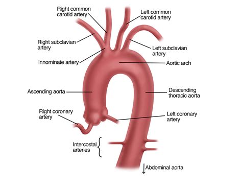Abdominal Aortic Aneurysm | UPMC