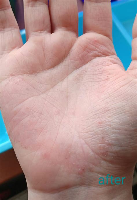 Wild Saint John’s Wort water - Hydrolina | InaEssentials.IE