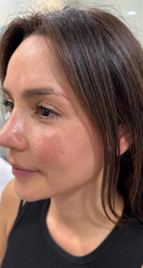 La condición que sufre Carmen Villalobos y contra la que batalla desde