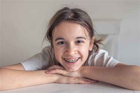 Best Braces Colors for You in 2025 | Celebrate Dental