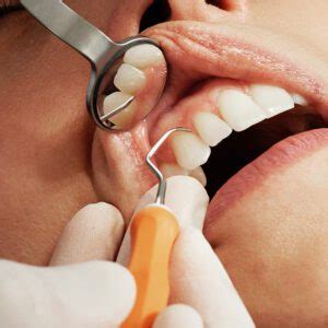 5 Common Dental Tools for Cleaning | Advanced Indiana