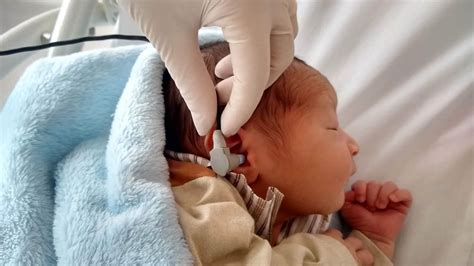 Como É Feito O Teste Da Orelhinha - Conheça a importância do teste da orelhinha | | Hospital São Francisco