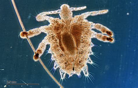 All Types of STDs & STIs and Their Symptoms | STD Blog