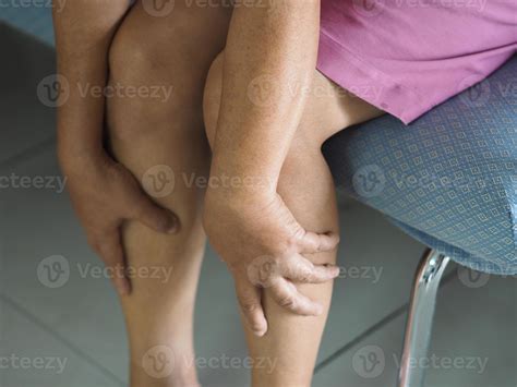 woman holding her leg pain rare disorder body immune system attacks
