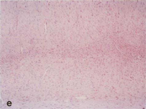 A Coronal section through the mid-dorsal level of the hippocampus. The ... 
