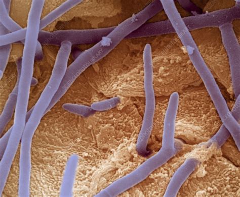 Trichophyton interdigitale - Stock Image - C009/4093 - Science Photo ...