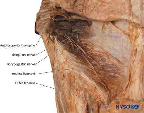 Ilioinguinal Nerve Anatomy