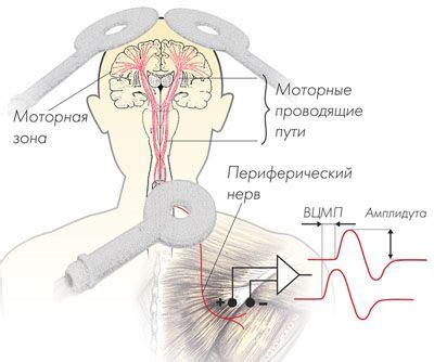 Магнитная стимуляция