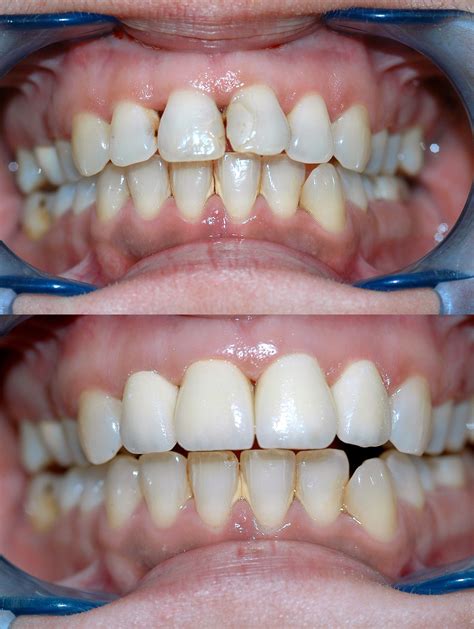Dental cases | Dental, Teeth, Quick