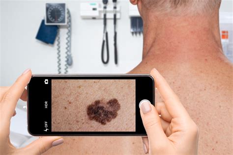 New App Uses AI To Classify Skin Conditions With the Snap of a Picture
