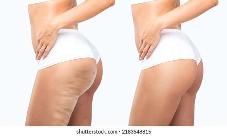 3,968 Fat White Girl Butts Royalty-Free Images, Stock Photos & Pictures ...
