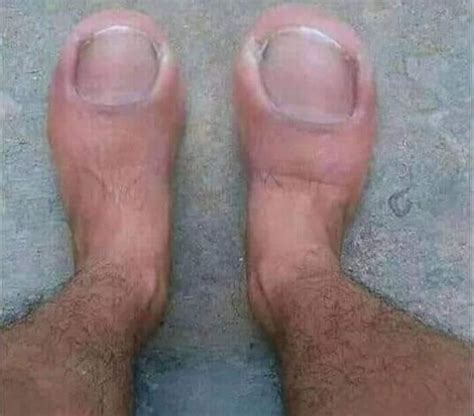 norfolk people evolve   toe