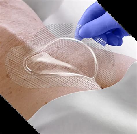 advanced wound care medline