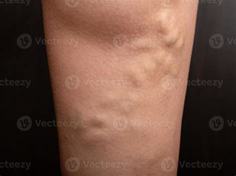 veins stock  images  backgrounds