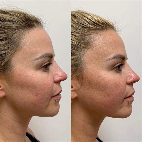 face threads near me 1