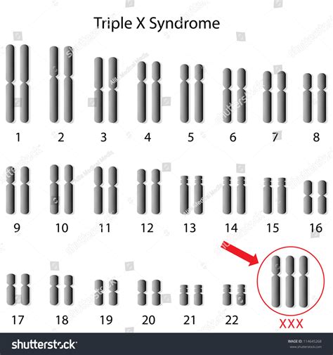 What Doctors WON'T Tell You About Triple X Syndrome: A Celebrity's Journey Image 13